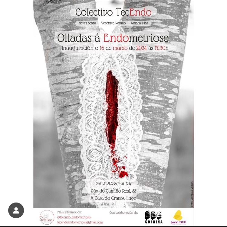 Inauguración da exposición «Olladas á endometriose»