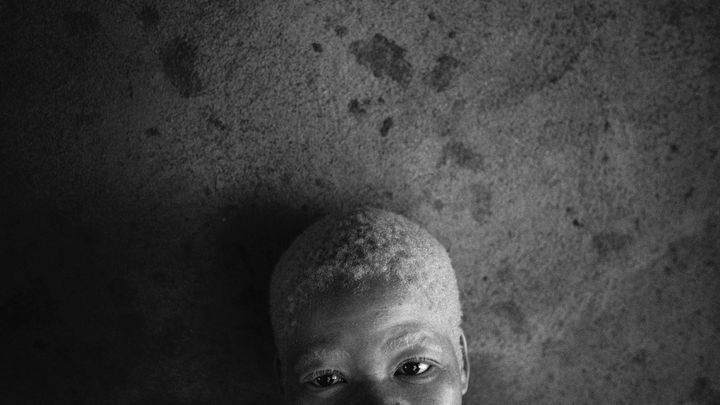 Inauguração da exposição virtual  'The Hunted – Albinos' de Daniel Rodrigues